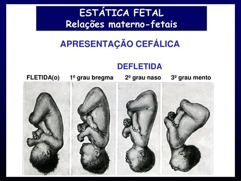 Fet Fyp Apresentacao De Fenda